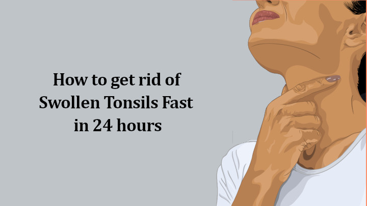 How to get rid of Swollen Tonsils Fast in 24 hours