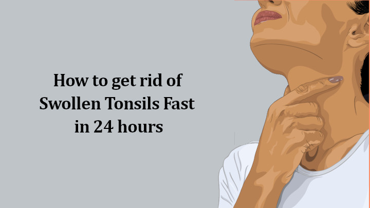 How To Get Rid Of Swollen Tonsils Fast In 24 Hours