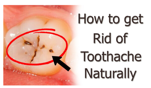 how-to-get-rid-of-toothache-fast-at-home-right-home-remedies