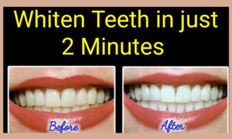 How to Whiten Yellow Teeth Naturally At Home in 2 Minutes