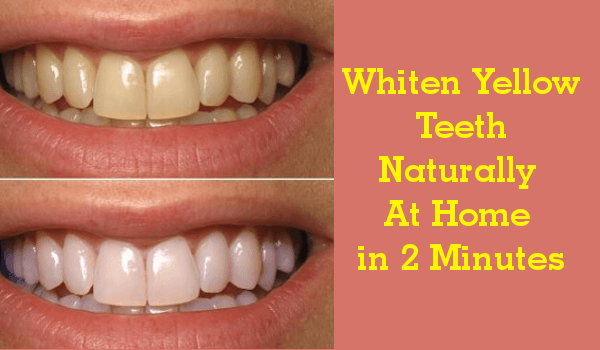 How To Whiten Yellow Teeth Naturally At Home In 2 Minutes Right Home