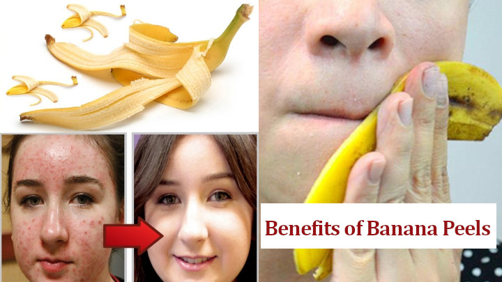 Benefits of Banana Peels