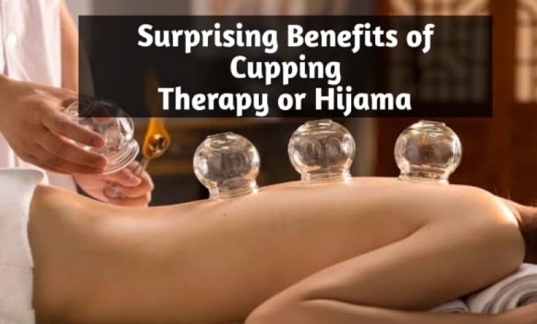 Surprising Benefits of Cupping Therapy or Hijama