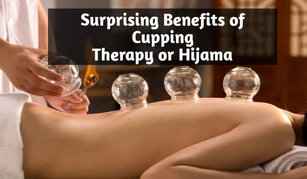 Surprising Benefits of Cupping Therapy or Hijama