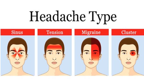 How to Cure Migraine Permanently without Any Medicine