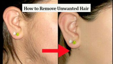 How to Remove Unwanted Hair