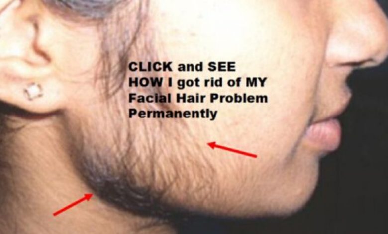 Remove unwanted hair permanently at home