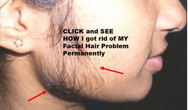 Remove unwanted hair permanently at home