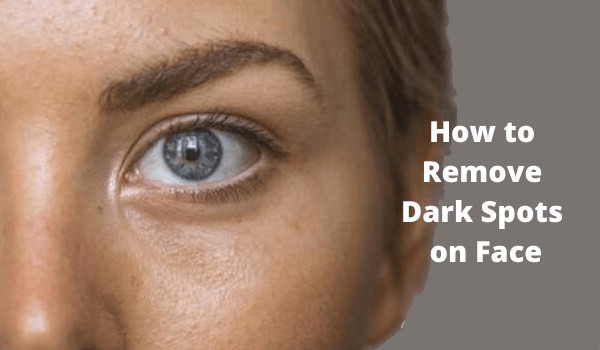 How to Remove Dark Spots on Face