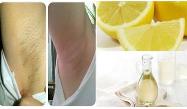 How to Get Rid of Dark Underarms Overnight Permanently