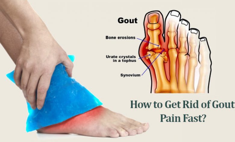 How to Get Rid of Gout Pain Fast