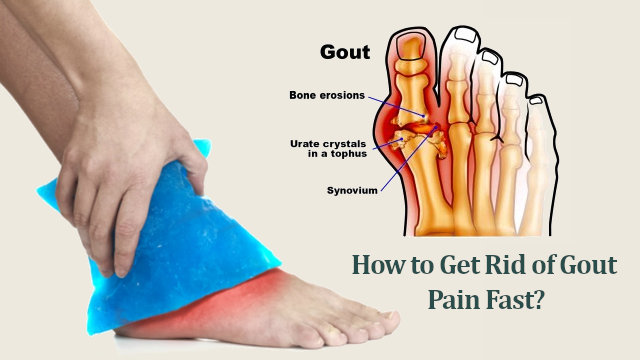 what is gout pain