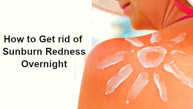 How to Get rid of Sunburn Redness