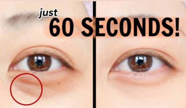 how-to-get-rid-of-eye-bags-sagging-skin-skin-best-skin-care-routine