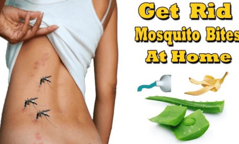 best way to stop mosquito bite itch