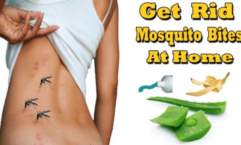 9 Home Remedies For Mosquito Bites Stop Itching Fast