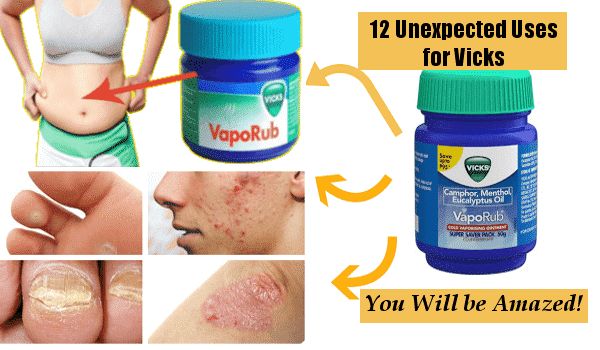 Vicks vaporub uses