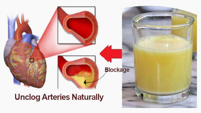 How to Unclog Arteries