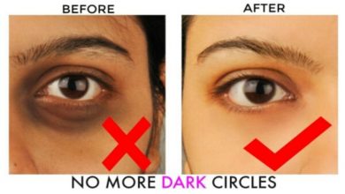 How to Remove Dark Circles in 2 Days
