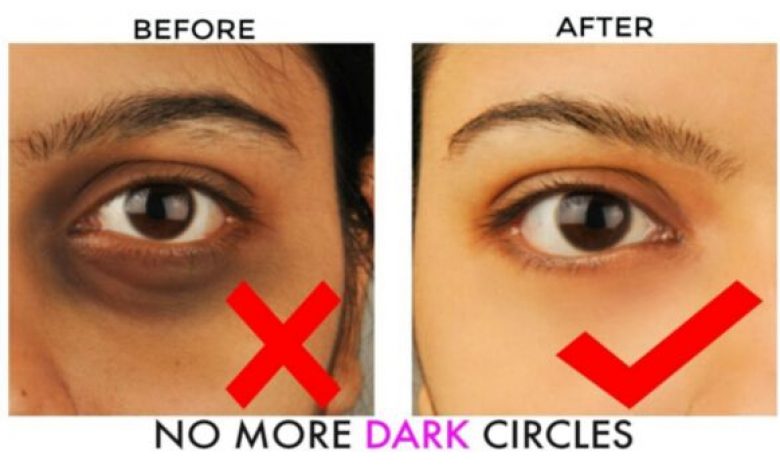 how-to-remove-dark-circles-in-2-days-permanently