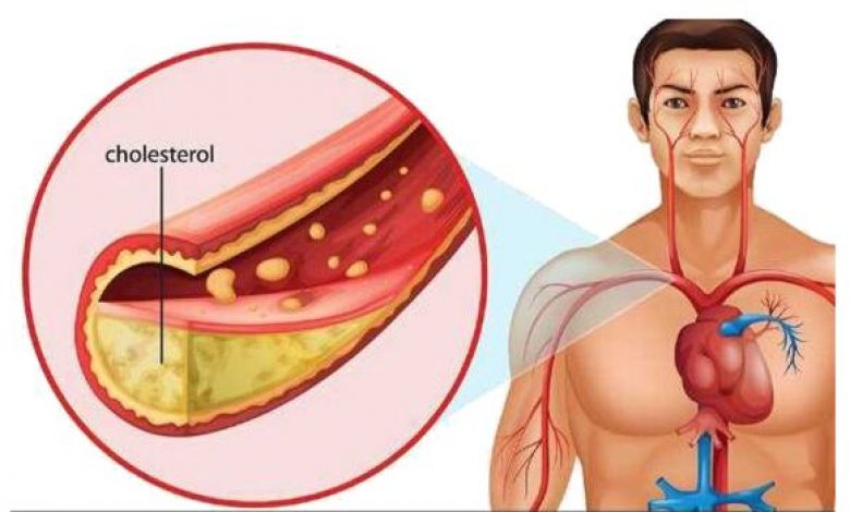 Foods that Lower Cholesterol Fast