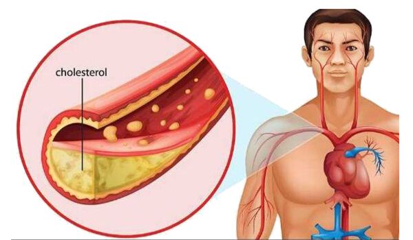Foods that Lower Cholesterol Fast