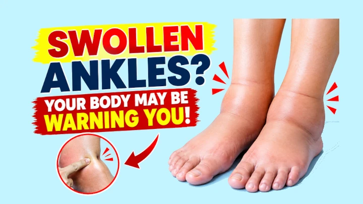SWOLLEN ANKLES? YOUR BODY MAY BE WARNING YOU!