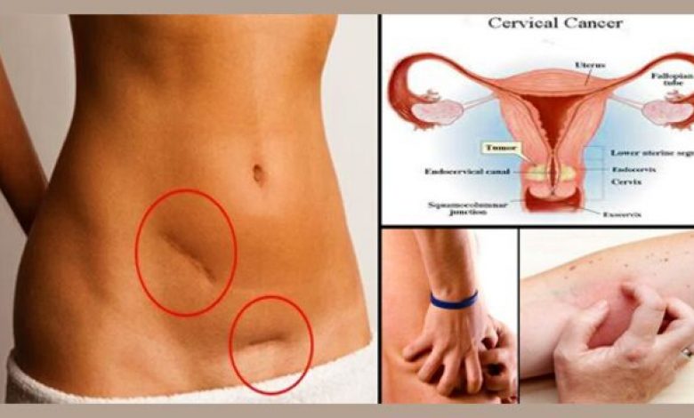 warning signs of cervical cancer