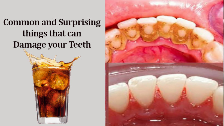 9 Most Surprising Things that can Damage your Teeth You must Know!