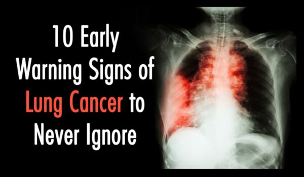 10 Early Warning Signs of Lung Cancer