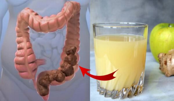 How to Cleanse Your Colon Quickly and safely at home