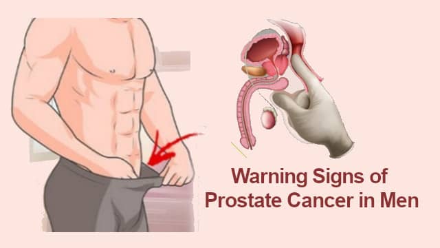 Early Warning Signs of Prostate Cancer in Men