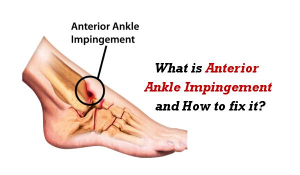 What is Anterior Ankle Impingement