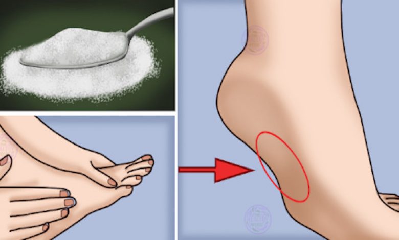 9 Warning Signs you are Eating Too Much Sugar