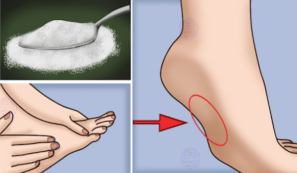 9 Warning Signs you’re Eating Too Much Sugar