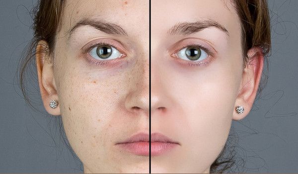 Air Might Be Ruining Your Skin