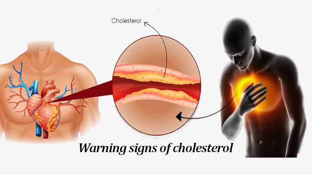 Symptoms Of High Cholesterol