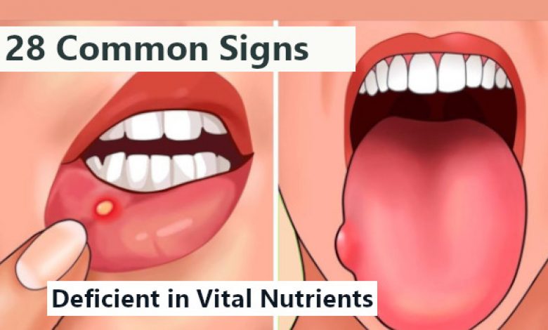 Signs your Body is Deficient in Vital Nutrients