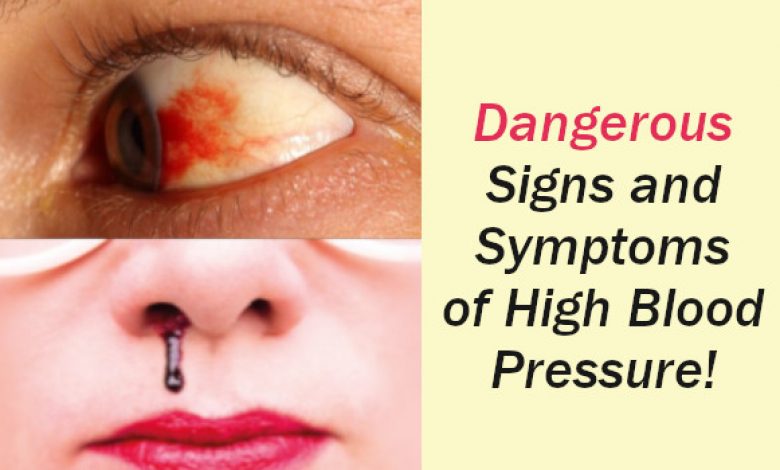 Signs and Symptoms of High Blood Pressure