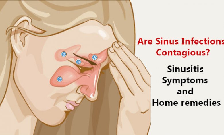 Are Sinus Infections Contagious