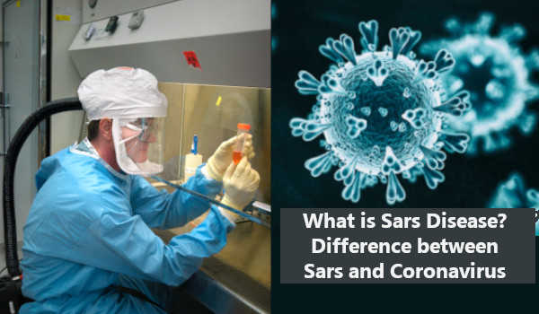 What is Sars Disease