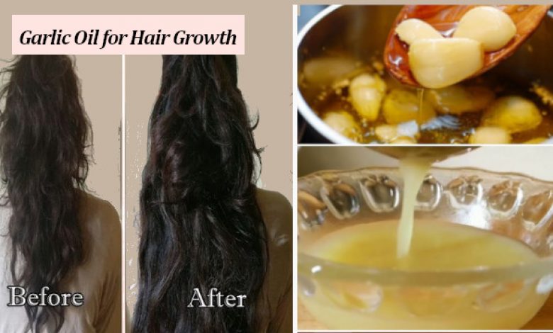 Garlic Oil for Hair