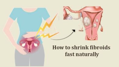 How to Shrink fibroids fast Naturally