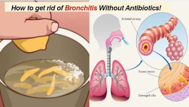Bronchitis Prevention