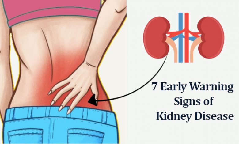 Signs and Symptoms of Kidney Disease Problems