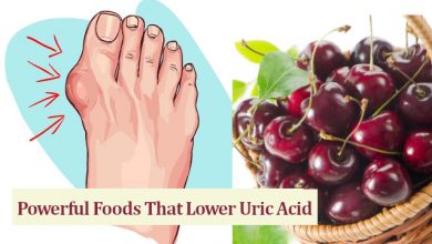 Foods That Lower Uric Acid