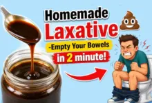 Homemade Laxative Recipe