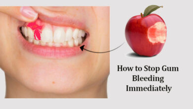 How to Stop Gum Bleeding Immediately