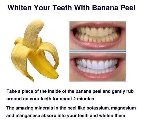 benefits of banana peel for teeth