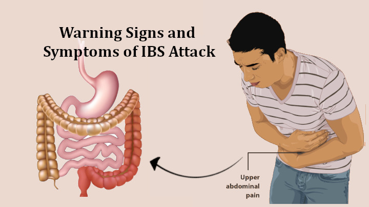 Symptoms of IBS Attack